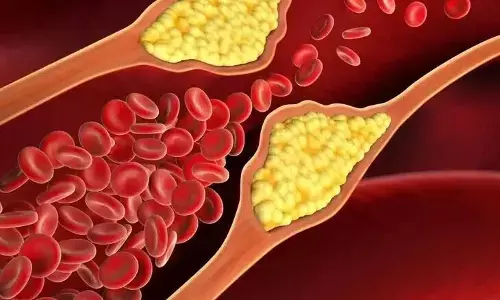 High Cholesterol: కనిపించని శత్రువు హై కొలెస్ట్రాల్: ఈ లక్షణాలను అస్సలు వదిలేయకండి!