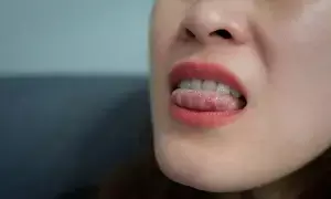 Troubled by Tongue Ulcers: నాలుకపై పుండ్లు వేధిస్తున్నాయా? ఈ చిట్కాలతో చెక్ పెట్టండి.. Troubled by Tongue Ulcers: నాలుకపై పుండ్లు వేధిస్తున్నాయా? ఈ చిట్కాలతో చెక్ పెట్టండి..