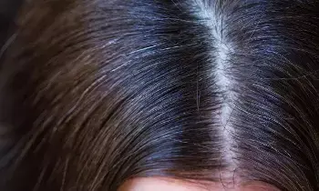 Grey Hair in Children at a Young Age: చిన్న వయసులోనే పిల్లల్లో తెల్ల జుట్టు వస్తోందా? కారణాలు, పరిష్కారాలు ఇవే..